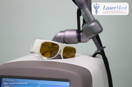 Circumcizia  cu laser
