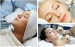 Epilare Definitiva   Electroli